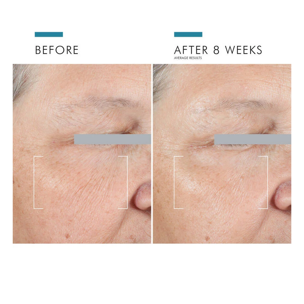 SkinCeuticals A.G.E. Advanced Eye