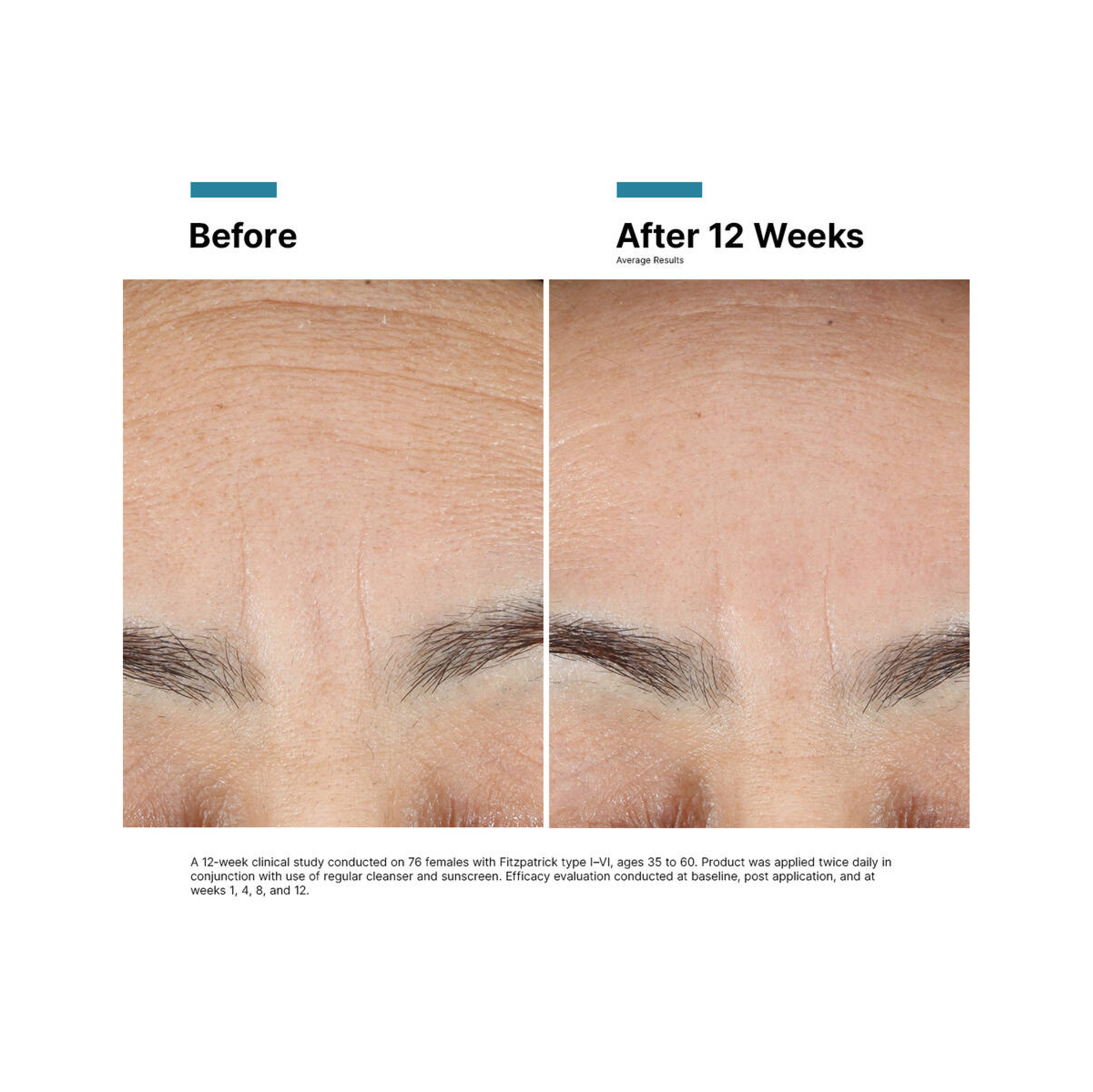 SkinCeuticals Advanced RGN-6