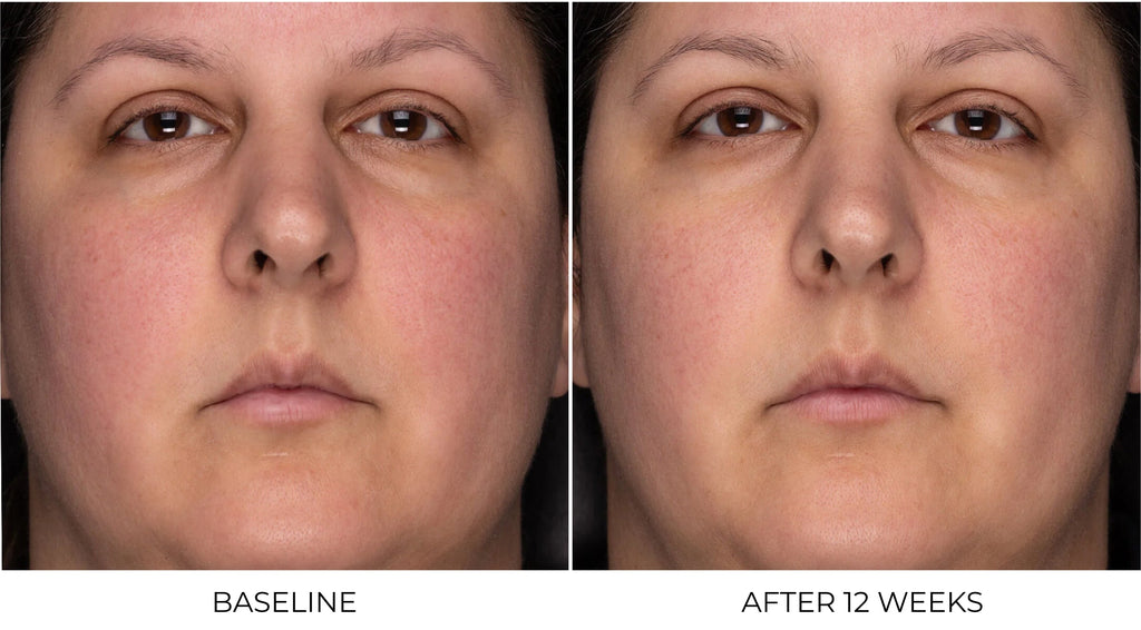 ZO Skin Health Recovery Crème