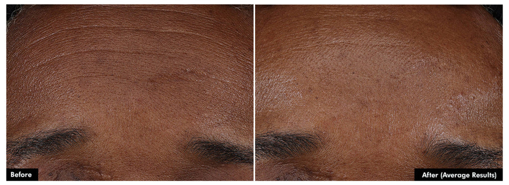 SkinCeuticals P-TIOX