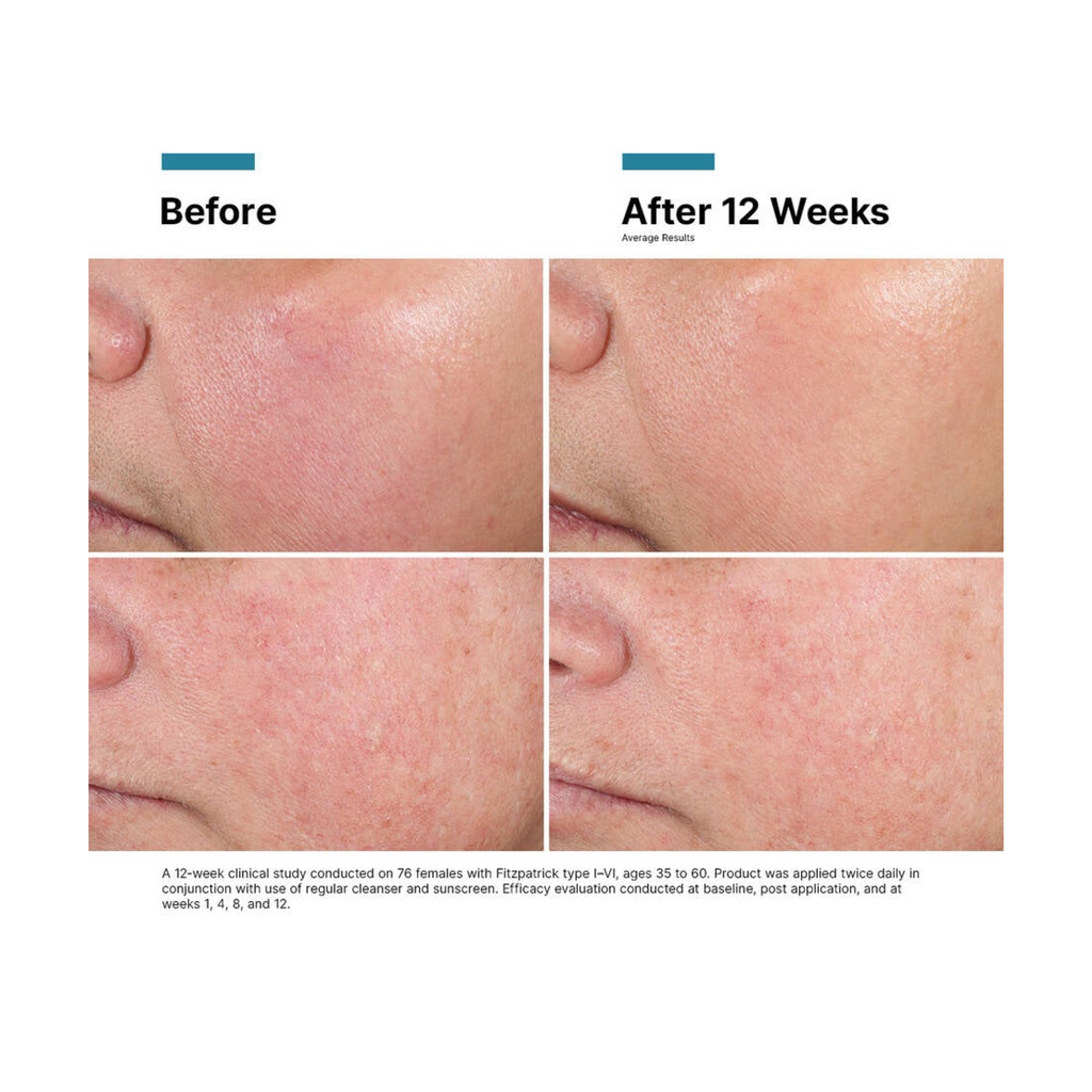 SkinCeuticals Advanced RGN-6