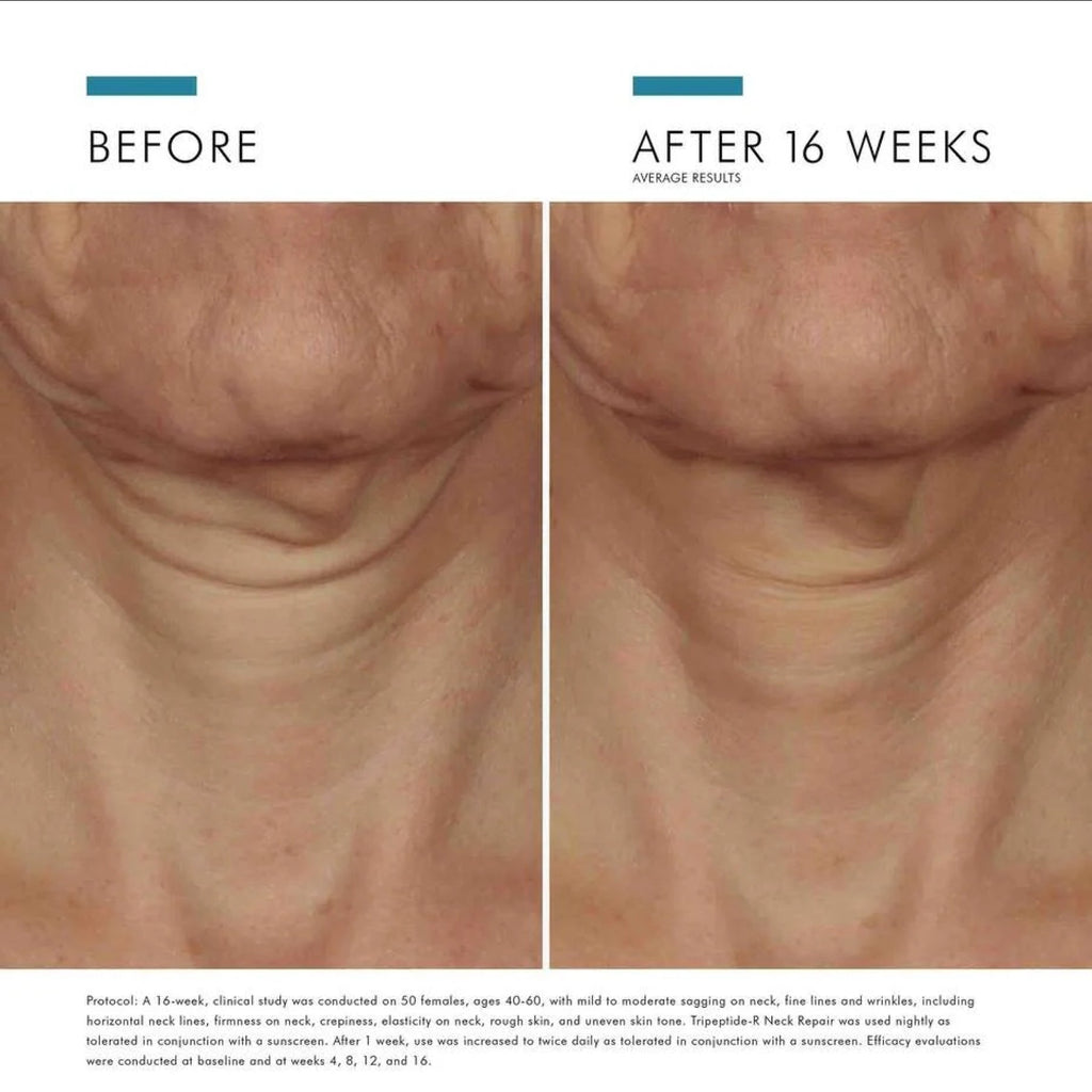 SkinCeuticals Tripeptide-R Neck Repair
