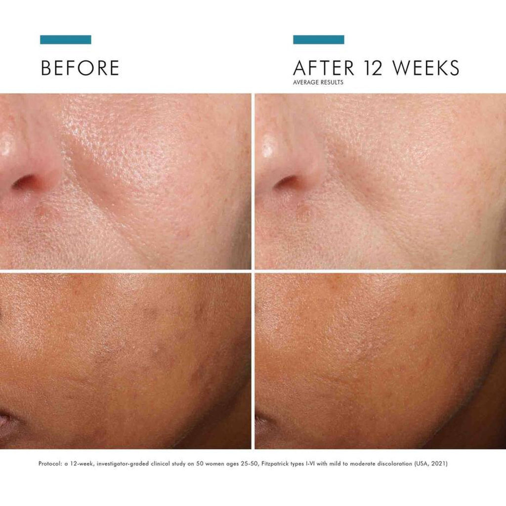 SkinCeuticals Phloretin CF® with Ferulic Acid