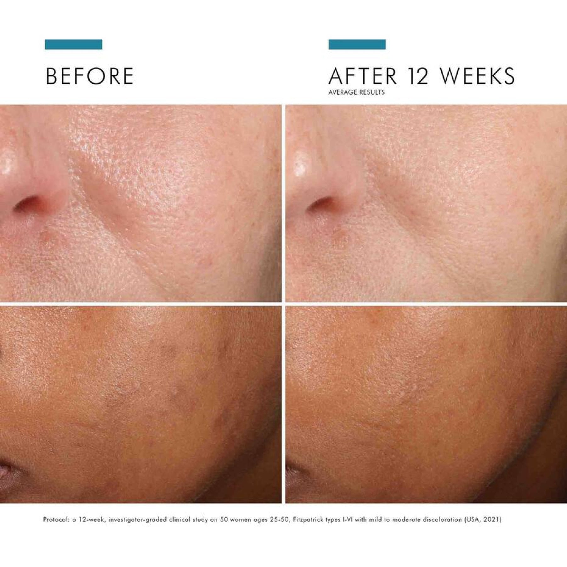 SkinCeuticals Phloretin CF® with Ferulic Acid