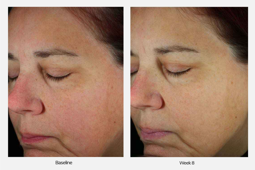 ZO Skin Health Next-Generation Daily Power Defense